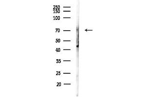anti-Prolyl Endopeptidase (PREP) (Internal Region) antibody