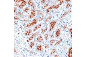Immunohistochemistry of paraffin-embedded mouse kidney using Syntaxin 3 Rabbit mAb (ABIN7270686) at dilution of 1:100 (40x lens). (STX3 Antikörper)