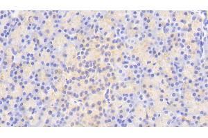 Detection of ATG16L1 in Human Pancreas Tissue using Polyclonal Antibody to Autophagy Related Protein 16 Like Protein 1 (ATG16L1) (ATG16L1 Antikörper  (AA 342-607))