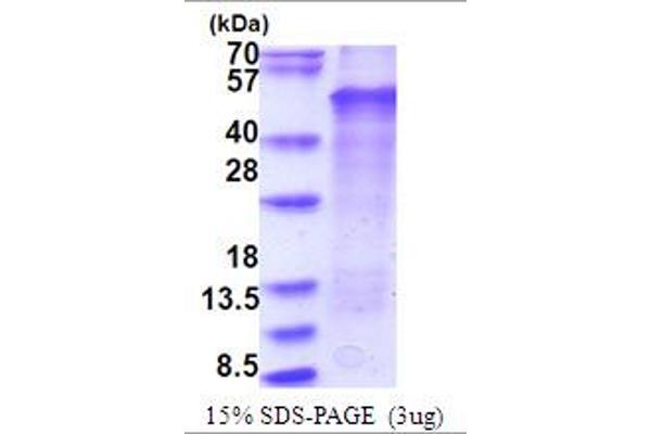 LMX1B Protein (AA 1-395) (His tag)
