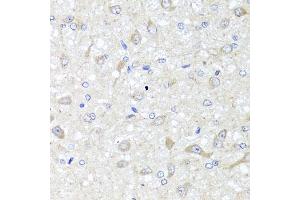Immunohistochemistry of paraffin-embedded rat brain using IL33 antibody (ABIN5995447) at dilution of 1/100 (40x lens). (IL-33 Antikörper)