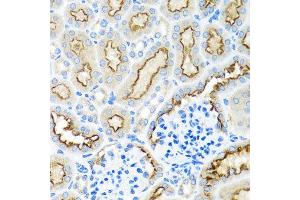Immunohistochemistry of paraffin-embedded mouse kidney using RPS2 antibody at dilution of 1:100 (x40 lens). (RPS2 Antikörper)