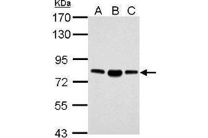 ACSL4 Antikörper  (C-Term)