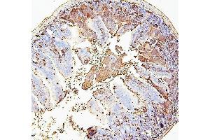 IHC analysis of RAB27A using anti-RAB27A antibody (ABIN7602714).