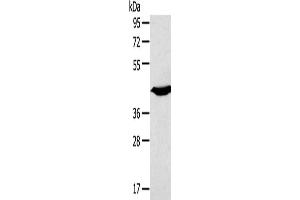 Gel: 8 % SDS-PAGE, Lysate: 40 μg, Lane: Mouse heart tissue, Primary antibody: ABIN7191189(KCNK3 Antibody) at dilution 1/200, Secondary antibody: Goat anti rabbit IgG at 1/8000 dilution, Exposure time: 10 seconds