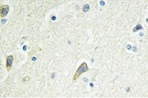 Immunohistochemistry analysis of EphB4 Antibody in paraffin-embedded human brain tissue. (EPH Receptor B4 Antikörper)