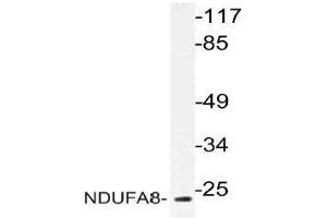 Western blot (WB) analysis of NDUFA8 antibody in extracts from 293 cells. (NDUFA8 Antikörper)