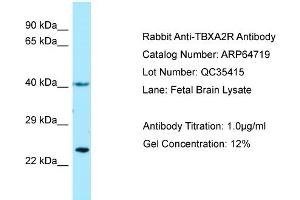 Western Blotting (WB) image for anti-Thromboxane A2 Receptor (TBXA2R) (N-Term) antibody (ABIN2789936) (TBXA2R Antikörper  (N-Term))