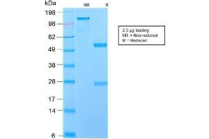 SDS-PAGE Analysis Purified NGFR Rabbit Recombinant Monoclonal Antibody (NGFR/2550R). (Rekombinanter NGFR Antikörper  (AA 281-421))