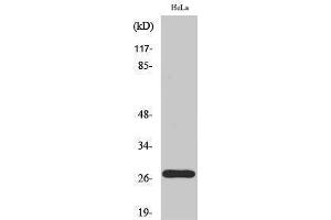 Western Blotting (WB) image for anti-P27 (pThr187) antibody (ABIN3182182) (P27 (pThr187) Antikörper)