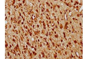 Immunohistochemistry (IHC) image for anti-DNA Fragmentation Factor, 40kDa, beta Polypeptide (Caspase-Activated DNase) (DFFB) (AA 108-219) antibody (ABIN7150177)