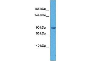 Host:  Rabbit  Target Name:  ACTN3  Sample Tissue:  Human 786-0 Whole Cell  Antibody Dilution:  1ug/ml (ACTN3 Antikörper  (N-Term))