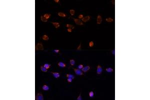 Immunofluorescence analysis of NIH/3T3 cells using PDH antibody (7432) at dilution of 1:100. (PDHA1 Antikörper)