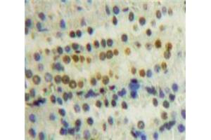 Used in DAB staining on fromalin fixed paraffin-embedded Kidney tissue (PPIE Antikörper  (AA 12-286))