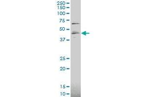 RUNX3 polyclonal antibody (A01), Lot # 070226JCSa Western Blot analysis of RUNX3 expression in HepG2 . (RUNX3 Antikörper  (AA 194-279))