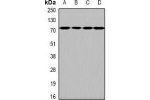 Western blot analysis of HPA2 expression in Hela (A), SKOV3 (B), mouse brain (C), rat brain (D) whole cell lysates. (Heparanase 2 Antikörper)