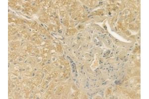 ABIN6259056 and ABIN6275435 at 1/100 staining human normal liver tissue by IHC-P.