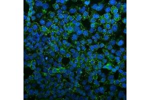 anti-Fms-Related Tyrosine Kinase 4 (FLT4) (AA 25-259) antibody