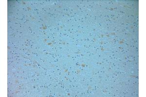 IHC on paraffin sections of human brain tissue using Goat antibody to NOS1: .