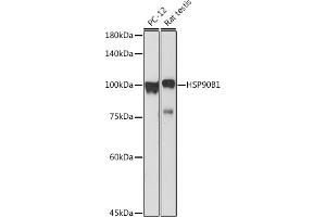 Western blot analysis of extracts of various cell lines, using HSP90B1 antibody (ABIN6130434, ABIN6142031, ABIN6142033 and ABIN7101795) at 1:1000 dilution. (GRP94 Antikörper  (AA 550-650))