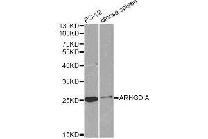 Western blot analysis of extracts of various cell lines, using ARHGDIA antibody. (ARHGDIA Antikörper  (AA 1-204))