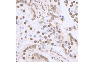 Immunohistochemistry (IHC) image for anti-Sp1 Transcription Factor (SP1) (C-Term) antibody (ABIN7458075)