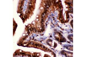 Anti-Caspase3 antibody, IHC(P) IHC(P): Mouse Intestine Tissue