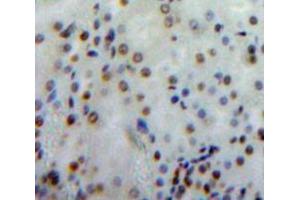 IHC-P analysis of Kidney tissue, with DAB staining. (Merlin Antikörper  (AA 30-239))
