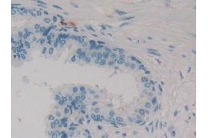 Detection of CR in Human Prostate Tissue using Polyclonal Antibody to Calretinin (CR)