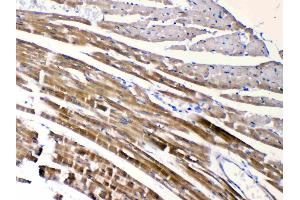 Immunohistochemistry (IHC) image for anti-Cholinergic Receptor, Nicotinic, alpha 5 (Neuronal) (CHRNA5) (AA 44-76), (N-Term) antibody (ABIN5518749)
