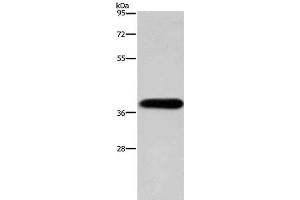 Western Blot analysis of HepG2 cell using PITX2 Polyclonal Antibody at dilution of 1:200 (PITX2 Antikörper)