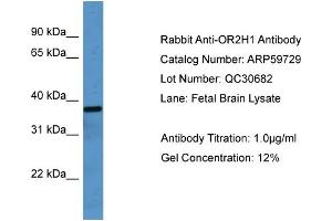 WB Suggested Anti-OR2H1  Antibody Titration: 0. (OR2H1 Antikörper  (C-Term))