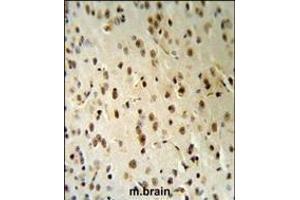 TARSL2 Antibody (C-term) (R) IHC analysis in formalin fixed and paraffin embedded human brain tissue followed by peroxidase conjugation of the secondary antibody and DAB staining. (TARSL2 Antikörper  (C-Term))