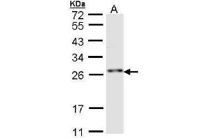 WB Image Sample (30 ug of whole cell lysate) A:Hep G2 , 12 % SDS PAGE antibody diluted at 1:1000 (RNF114 Antikörper)