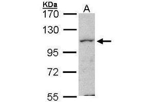 WB Image Sample (30 ug of whole cell lysate) A: Hela 7. (MAP4K1 Antikörper  (N-Term))