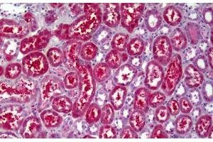 Immunohistochemistry (IHC) image for anti-ATPase, H+ Transporting, Lysosomal 56/58kDa, V1 Subunit B2 (ATP6V1B2) antibody (ABIN961324)