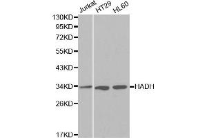 Western blot analysis of extracts of various cell lines, using HADH antibody (ABIN5970434) at 1/1000 dilution. (HADH Antikörper)