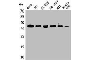 Western Blot analysis of K562 293 SK-HEP-1 SHSY5Y M21 mouse eye cells using RRP7A Polyclonal Antibody (RRP7A Antikörper  (C-Term))