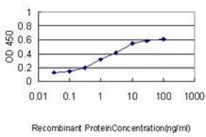 Detection limit for recombinant GST tagged PIM1 is approximately 0. (PIM1 Antikörper  (AA 1-100))