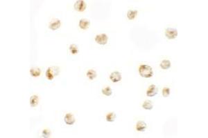 Immunocytochemistry of PRICKLE4 in A549 cells with PRICKLE4 antibody at 5 ug/mL. (PRICKLE4 Antikörper  (N-Term))