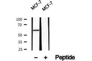 Western blot analysis of extracts of MCF7 cells, using PKLR antibody. (PKLR Antikörper  (Internal Region))