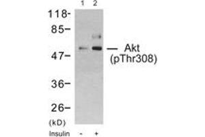 Western blot analysis of extracts from 293 cells treated with Insulin, using Akt (Phospho-Thr308) Antibody.