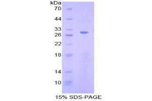 SDS-PAGE analysis of Mouse Cyclin D2 Protein.