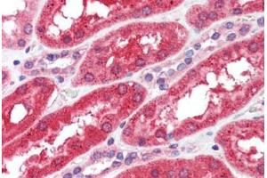 Human Kidney (formalin-fixed, paraffin-embedded) stained with FGFR4 antibody ABIN462303 followed by biotinylated anti-mouse IgG secondary antibody ABIN481714, alkaline phosphatase-streptavidin and chromogen. (FGFR4 Antikörper)