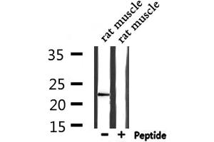 Western Blotting (WB) image for anti-CD3 epsilon (CD3E) (C-Term) antibody (ABIN6260619)