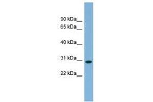 Image no. 1 for anti-Chromosome 11 Open Reading Frame 57 (C11orf57) (AA 107-156) antibody (ABIN6744127) (C11orf57 Antikörper  (AA 107-156))