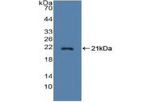 Detection of Recombinant STMN1, Human using Polyclonal Antibody to Stathmin 1 (STMN1) (Stathmin 1 Antikörper  (AA 2-149))