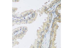 Immunohistochemistry of paraffin-embedded human prostate using IGFBP4 antibody at dilution of 1:100 (40x lens).