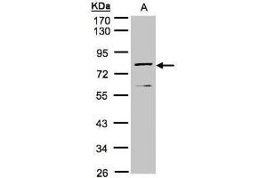 WB Image Sample(30 μg of whole cell lysate) A:MOLT4, 10% SDS PAGE antibody diluted at 1:1000 (DPP3 Antikörper)