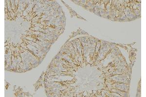 ABIN6274641 at 1/100 staining Mouse testis tissue by IHC-P. (CYP26C1 Antikörper  (Internal Region))